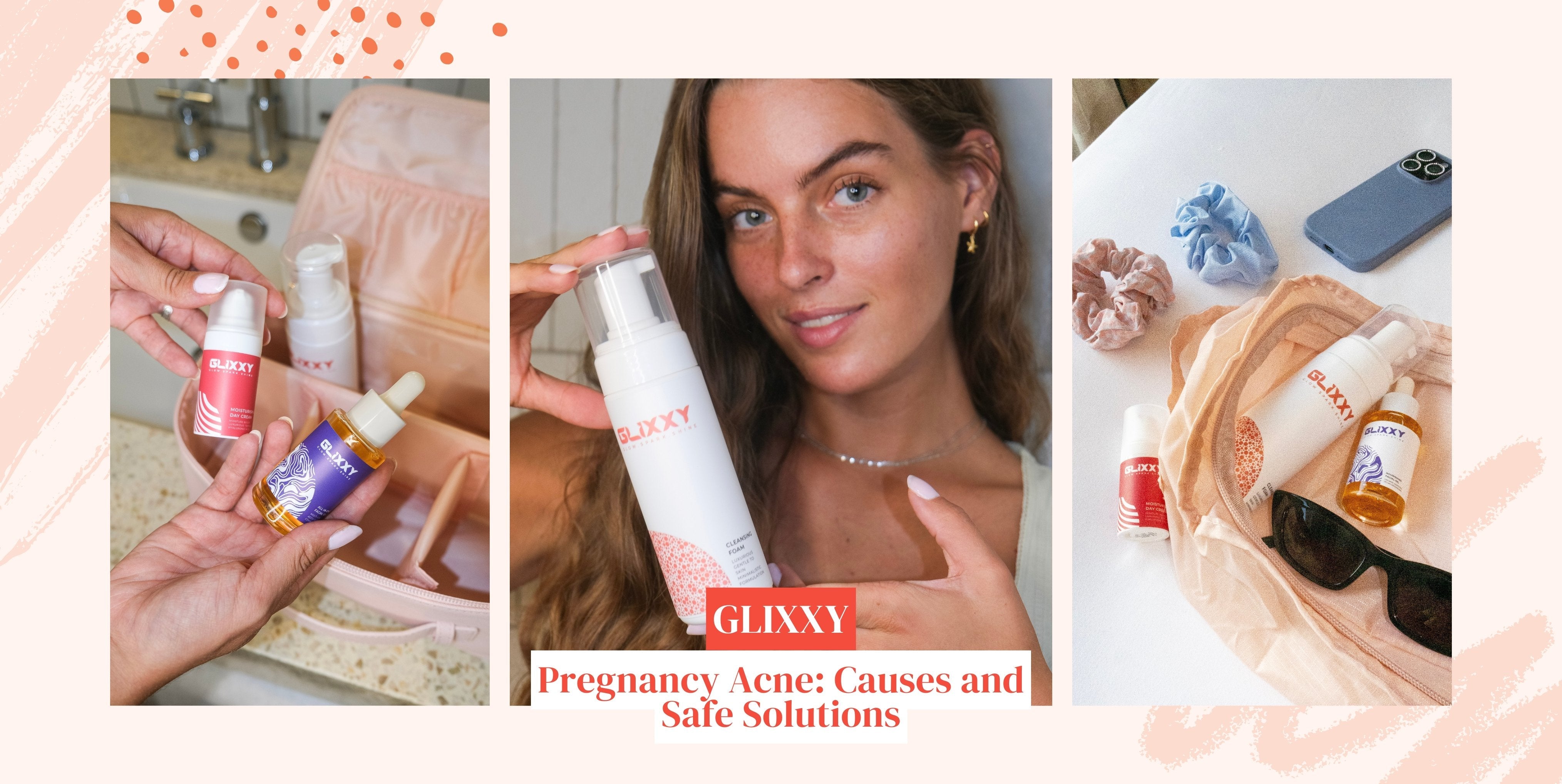 Pregnancy Acne: Causes and Safe Solutions