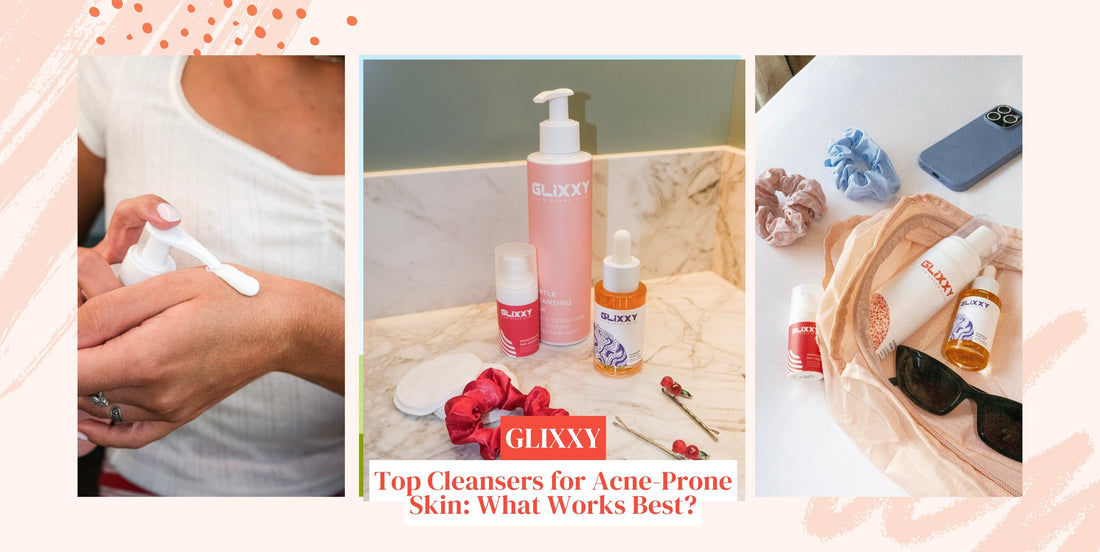 Top Cleansers for Acne-Prone Skin: What Works Best?