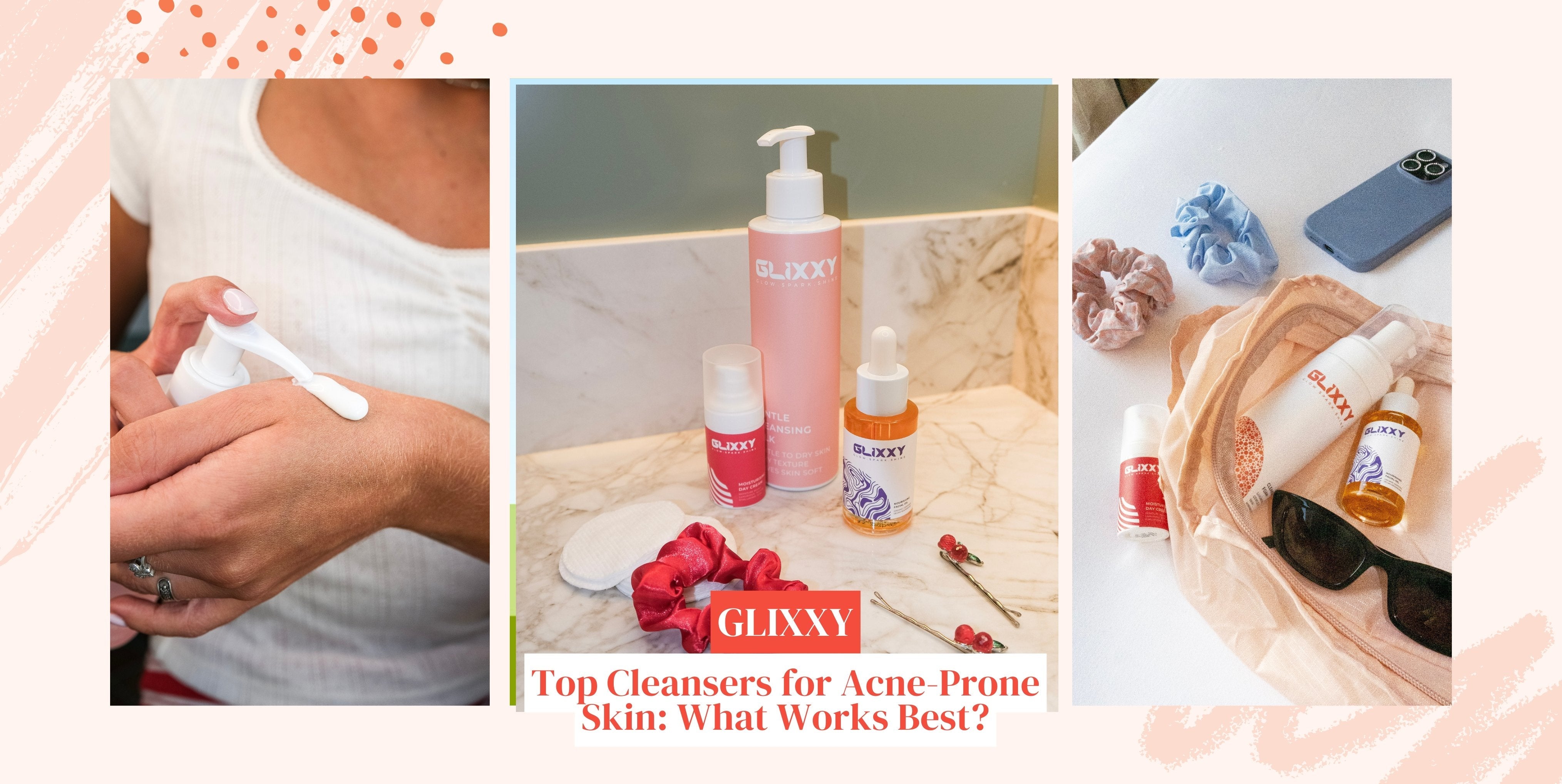 Top Cleansers for Acne-Prone Skin: What Works Best?