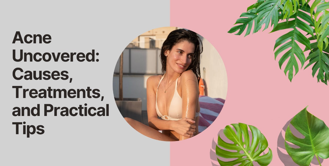 Acne Uncovered: Causes, Treatments, and Practical Tips
